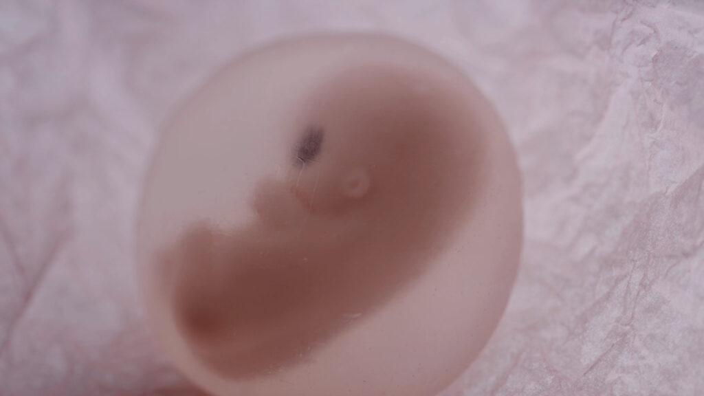 Abortion is Healthcare
