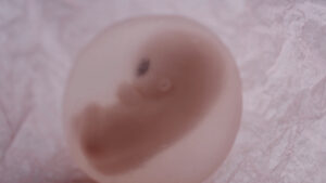 Abortion is Healthcare